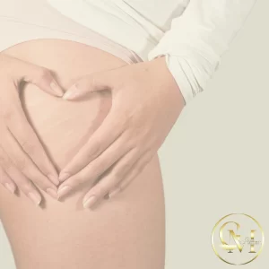 stretch mark reconstruction