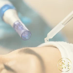 Facial Microneedling